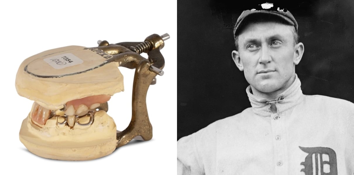 MLB Legend Ty Cobb's Dentures Up For Auction, Top & Bottom False Teeth