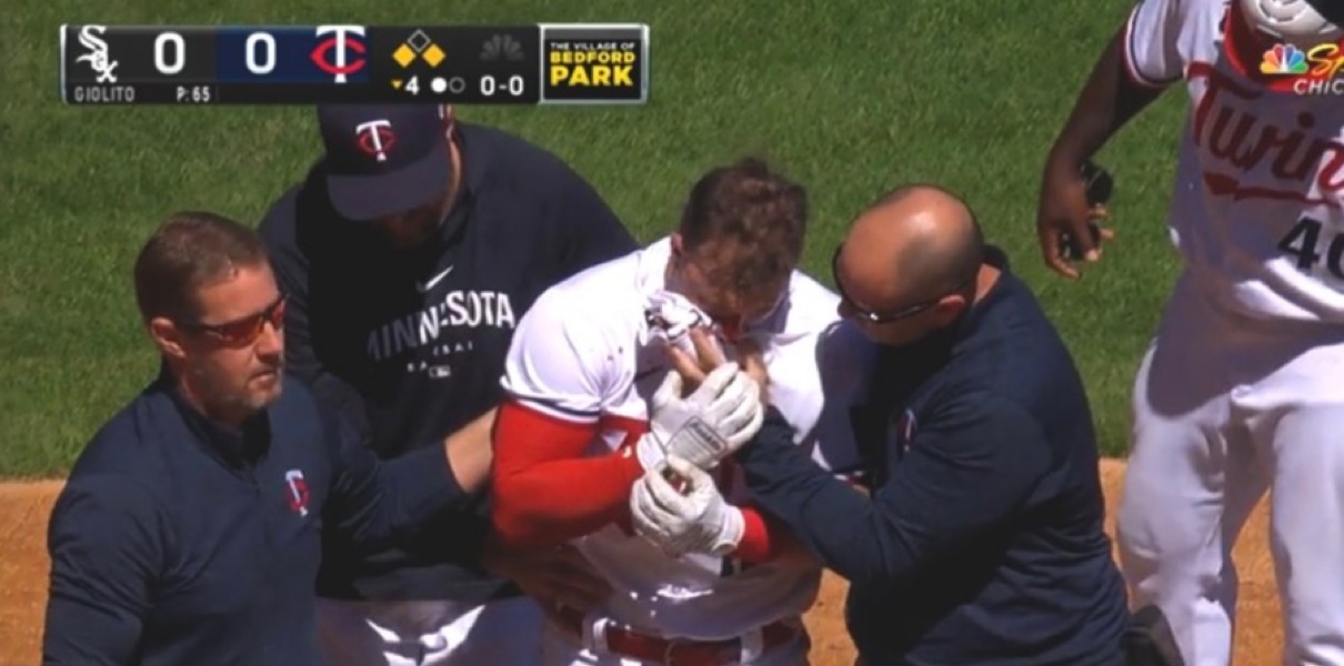 Kyle Farmer hit in face by pitch, 04/12/2023